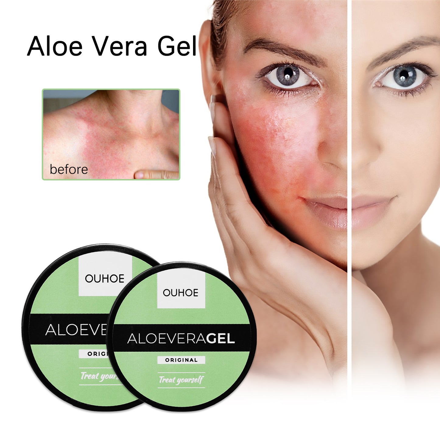 Achieve a Radiant Summer Glow: Tanning Gel & Aloe Vera for Sun-Kissed Skin