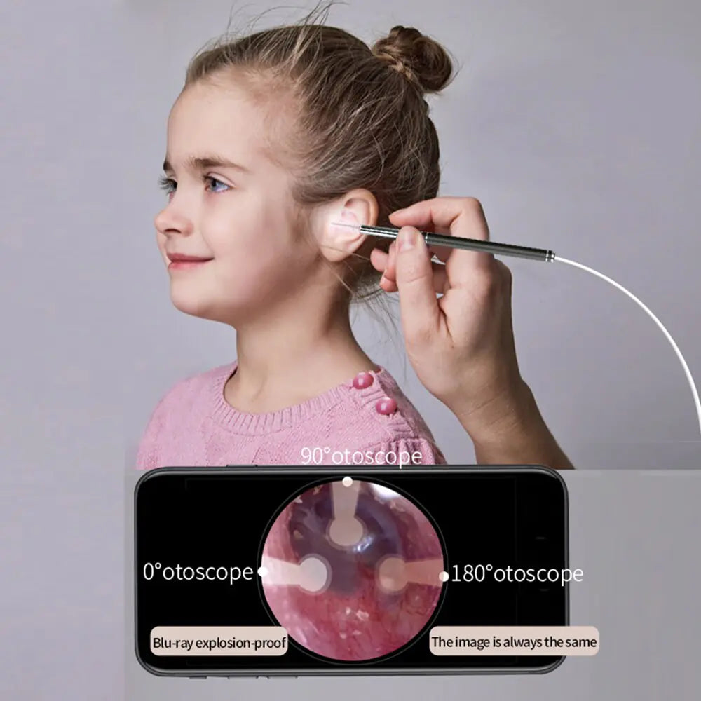 Smart Earwax Removal Tool w/ Camera 29.99 THIS WEEK! LIMITED QUANTITY!