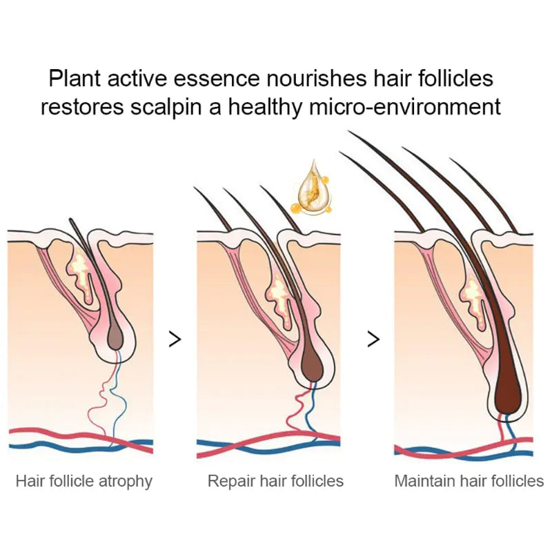Boost Hair Growth Naturally: Rosemary Oil for Men