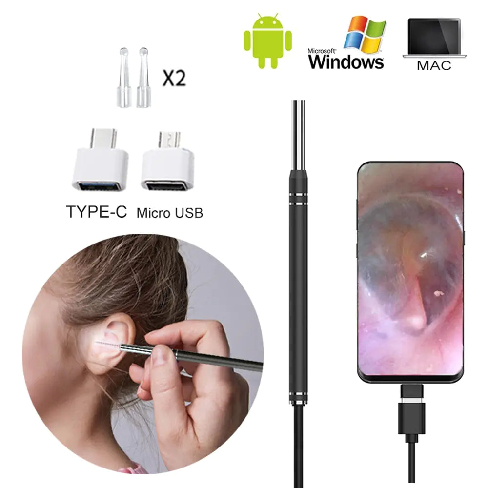 Smart Earwax Removal Tool w/ Camera 29.99 THIS WEEK! LIMITED QUANTITY!