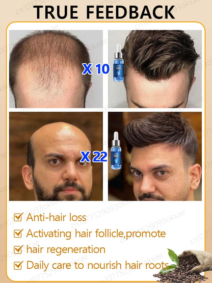 Revitalize Your Hair: Fast-Acting Hair Growth Essence