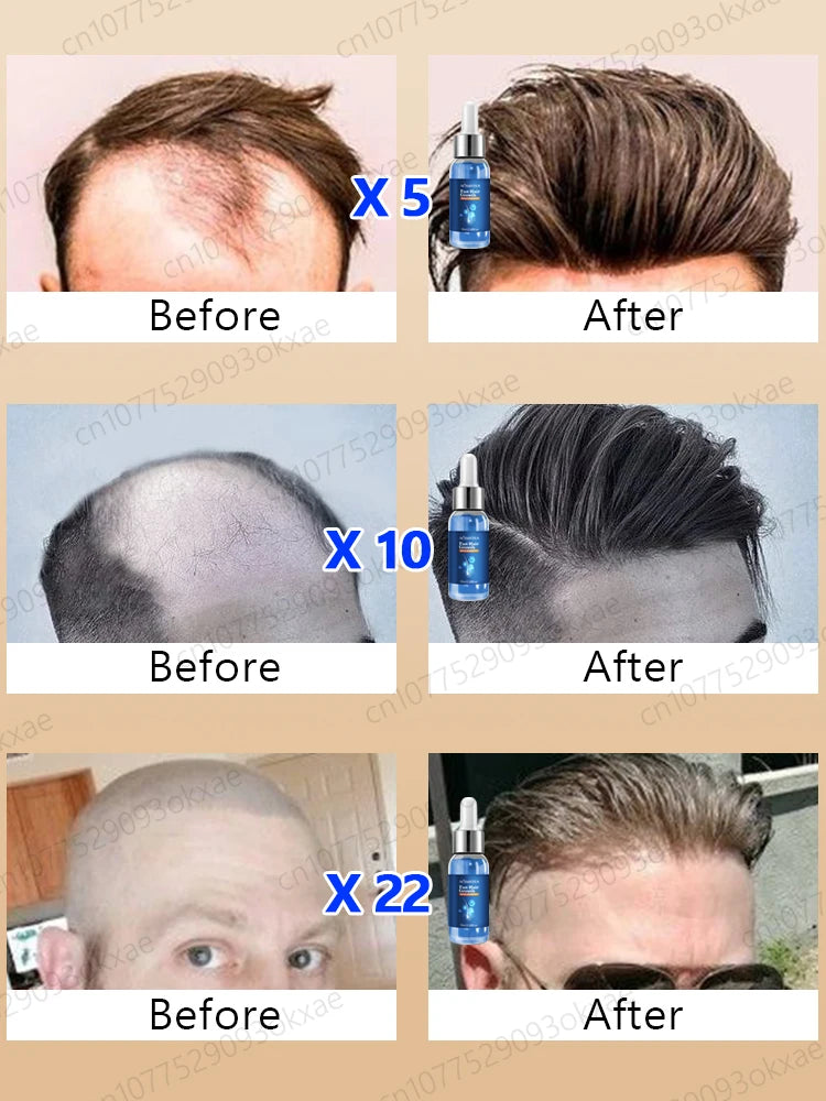 Revitalize Your Hair: Fast-Acting Hair Growth Essence